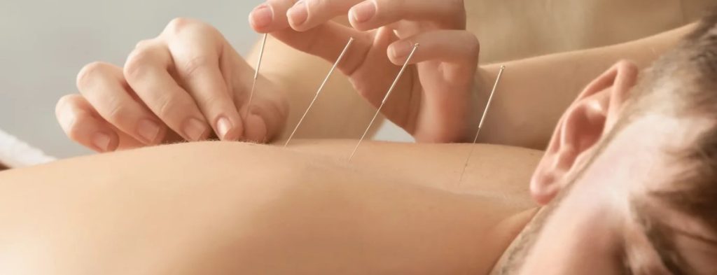 Auckland Cupping at Yulimclinic – Natural Healing Therapy