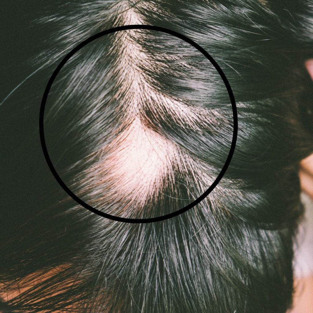 Wigs For Alopecia | Wigmedical.com