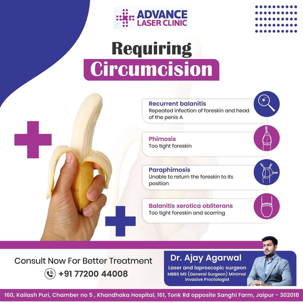 ZSR Circumcision doctor in Jaipur