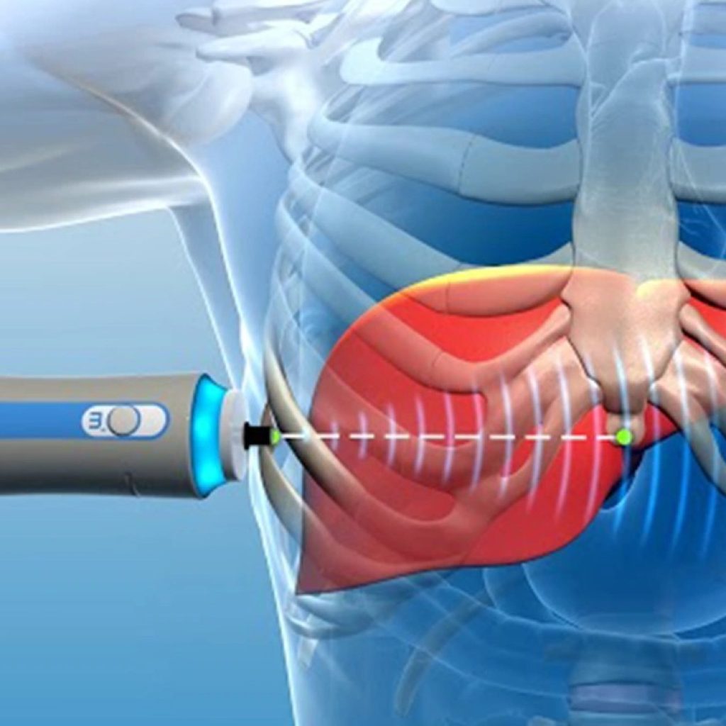 Best Gastroenterologist Ahmedabad: Expert GI Care Best Gastroenterologist Ahmedabad: Expert GI Care