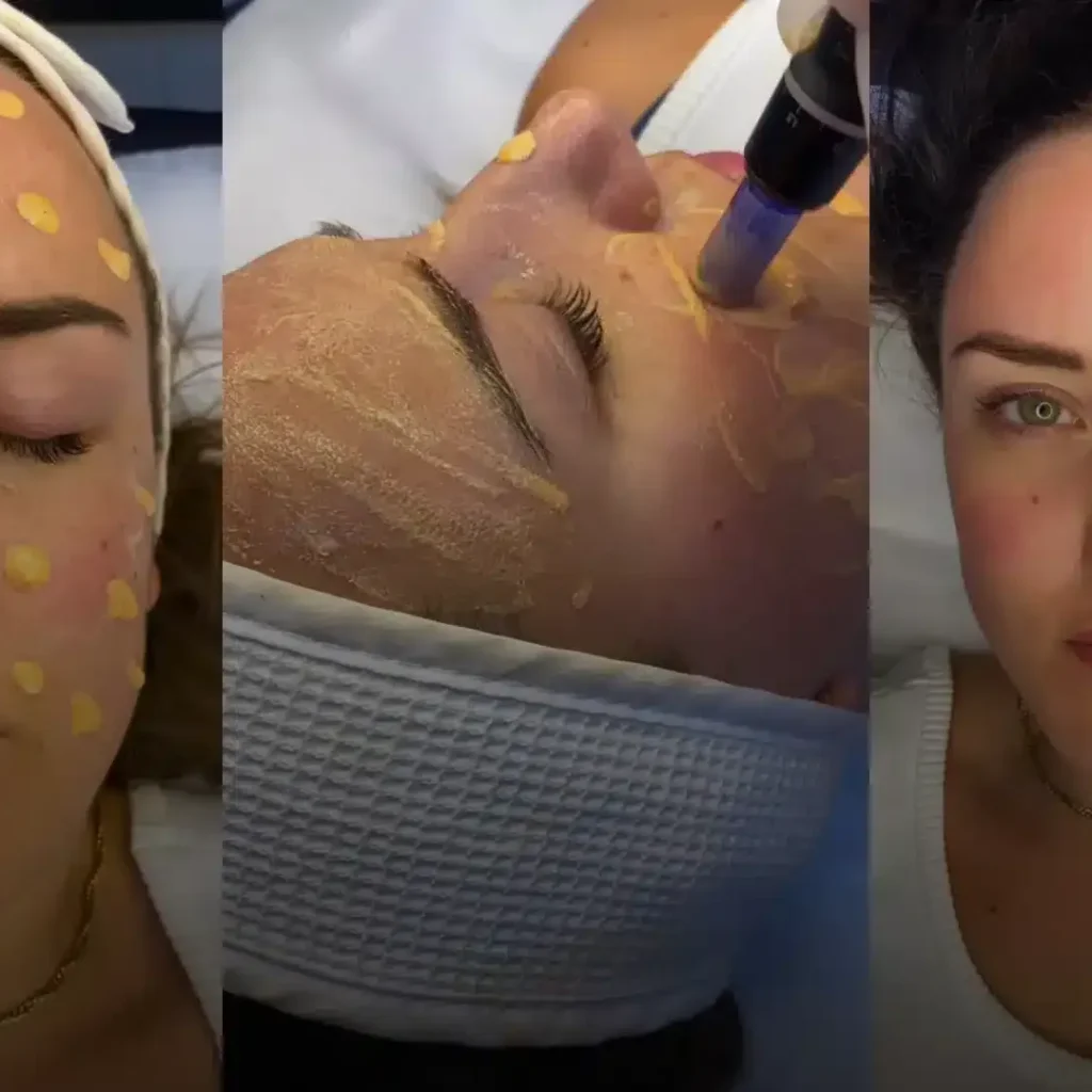 Permanent Scar Concealment in Dubai: Subtle, Safe Solutions