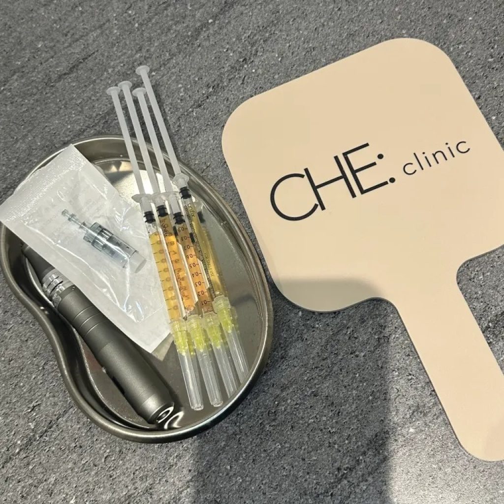 Microneedling With Prp | Thecheclinic.co.uk Microneedling With Prp | Thecheclinic.co.uk