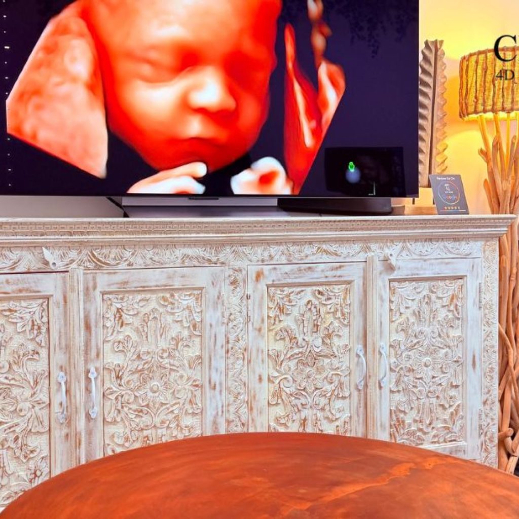 Capture Your Baby’s First Moments: Perth 3D/4D Scans with Confidence Capture Your Baby’s First Moments: Perth 3D/4D Scans with Confidence