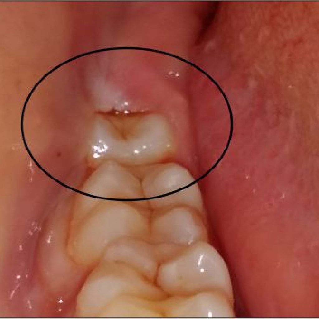 Trusted Dental Clinic Rajkot – Gentle Care for Smiles
