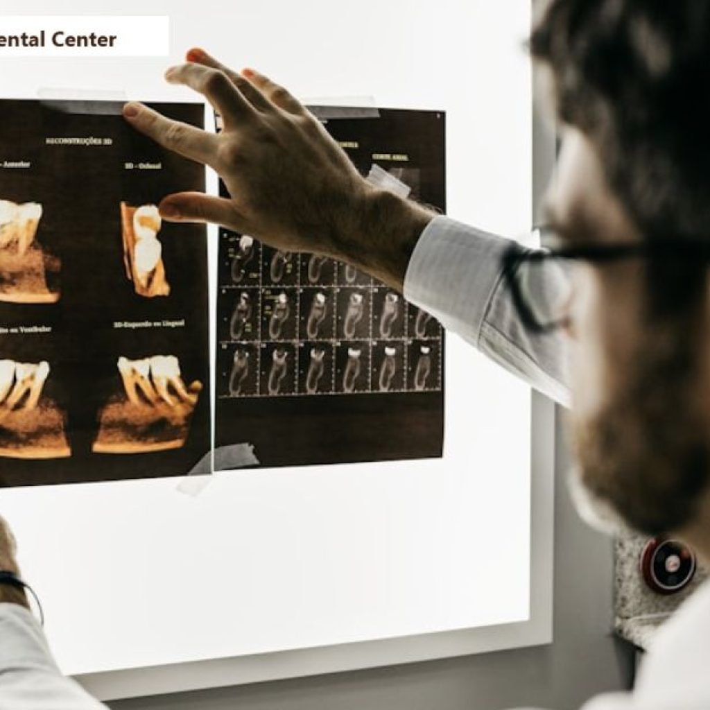 حشوات تجميلية للأسنان | Edhakcenter.com حشوات تجميلية للأسنان | Edhakcenter.com