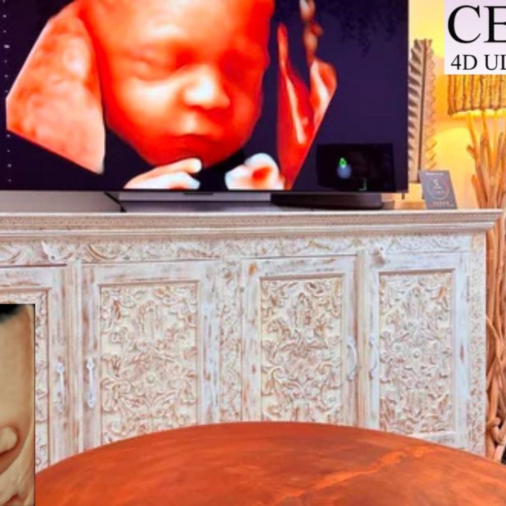 Capture Your Baby’s First Moments with a 4D Scan in Western Australia