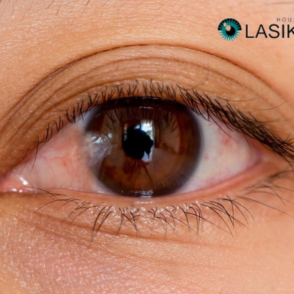 Guide to Comfort and Healing After Eye Surgery Guide to Comfort and Healing After Eye Surgery