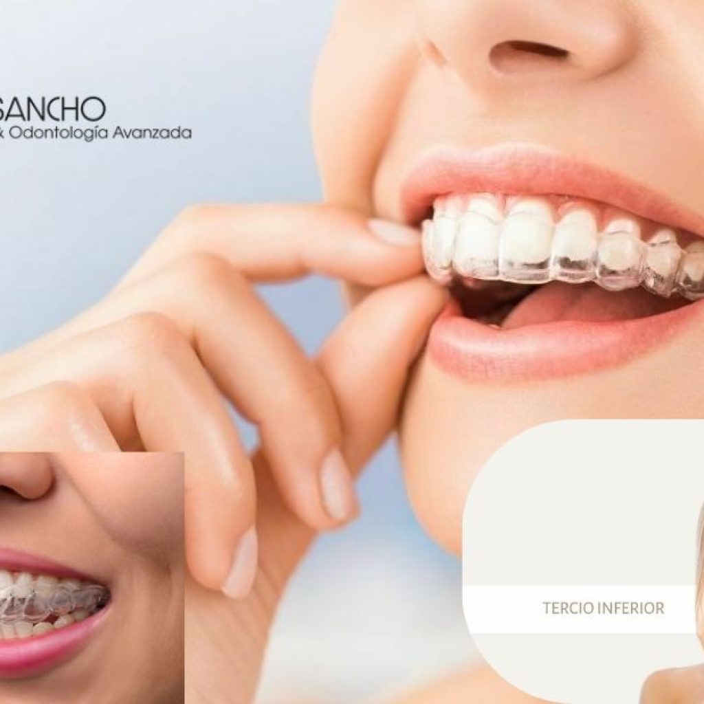 Tu clÃnica dental de confianza en Pozuelo, cerca de Avenida Europa Tu clÃnica dental de confianza en Pozuelo, cerca de Avenida Europa