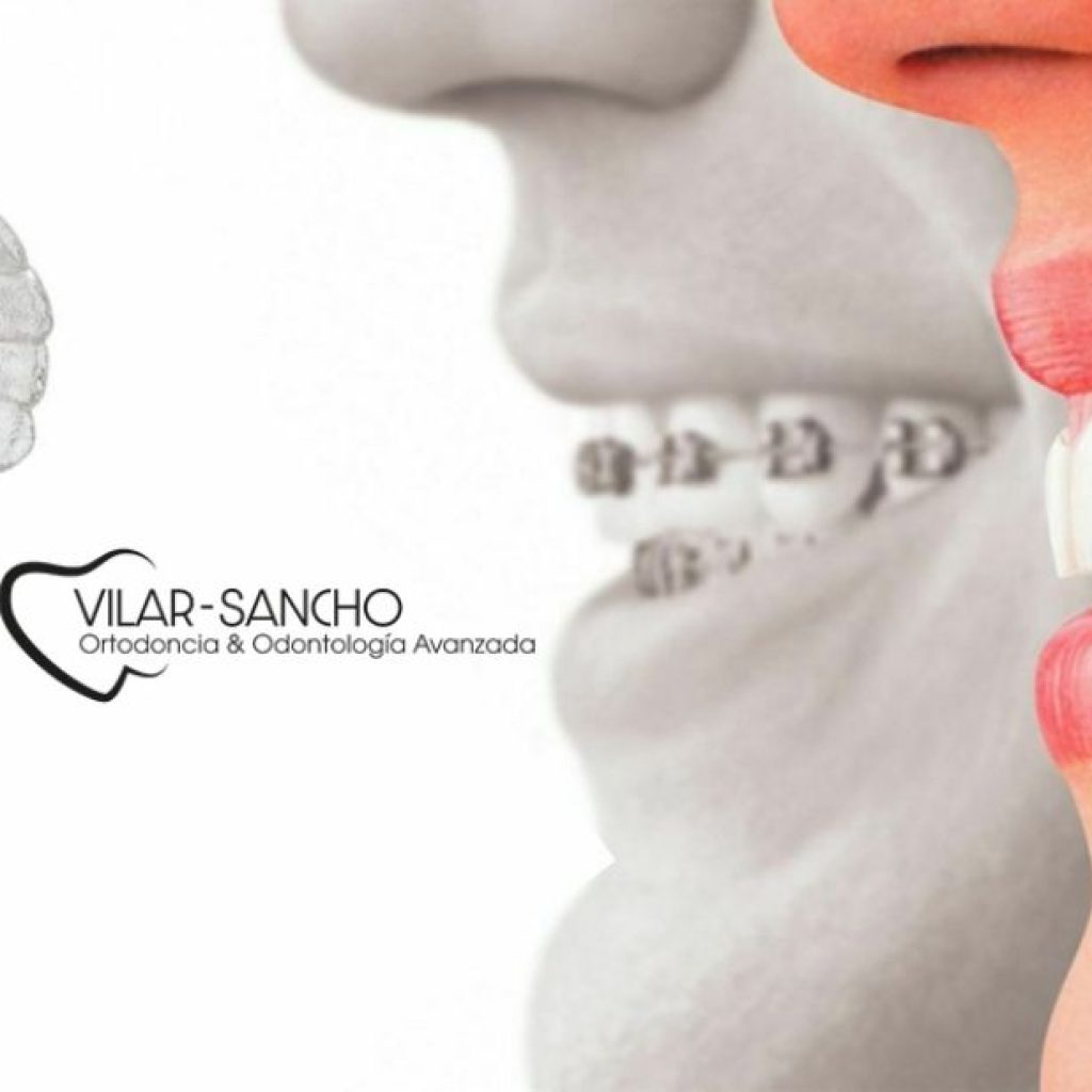 Cuidados dentales esenciales en Pozuelo de Alarcón para una sonrisa sana