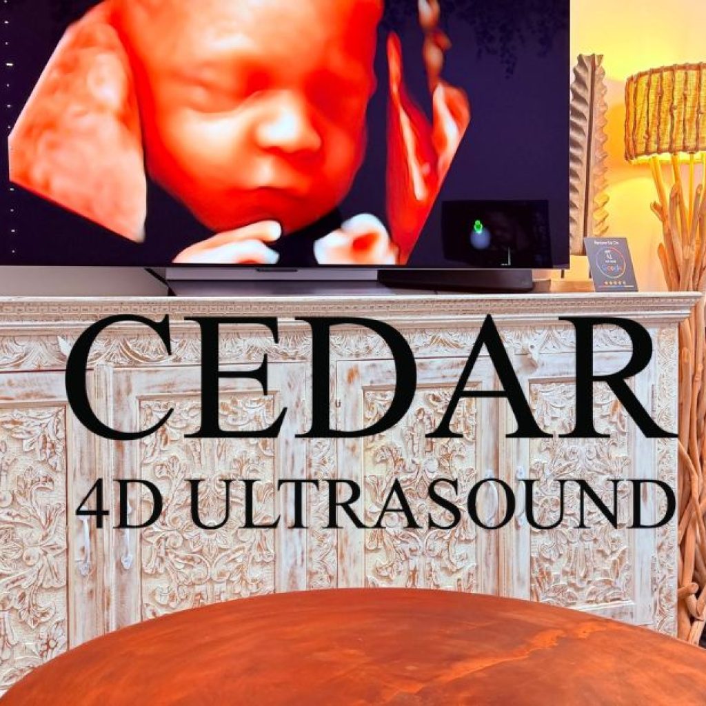 Trusted sonography scans in Western Australia for expectant families