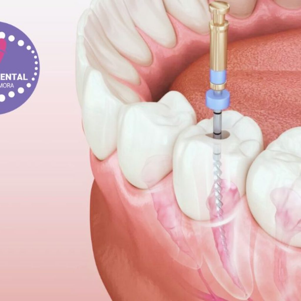 Somriure radiant: alternatives d’estètica dental a la zona de Gines