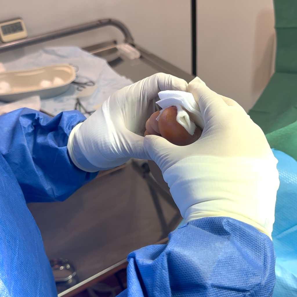 Urgent nail care: fast relief from skilled UK specialists Urgent nail care: fast relief from skilled UK specialists