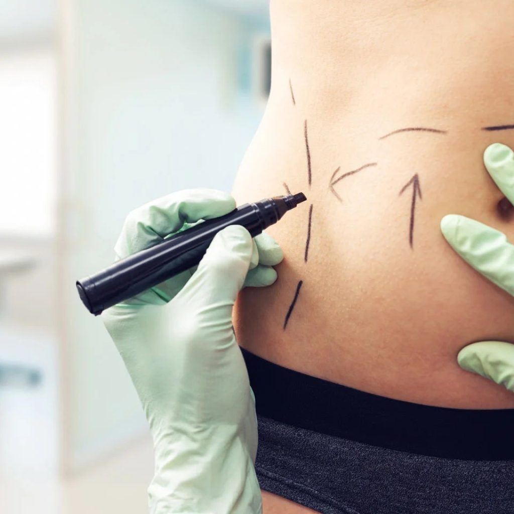 Elevate Your Confidence with a Melbourne Breast Lift Elevate Your Confidence with a Melbourne Breast Lift