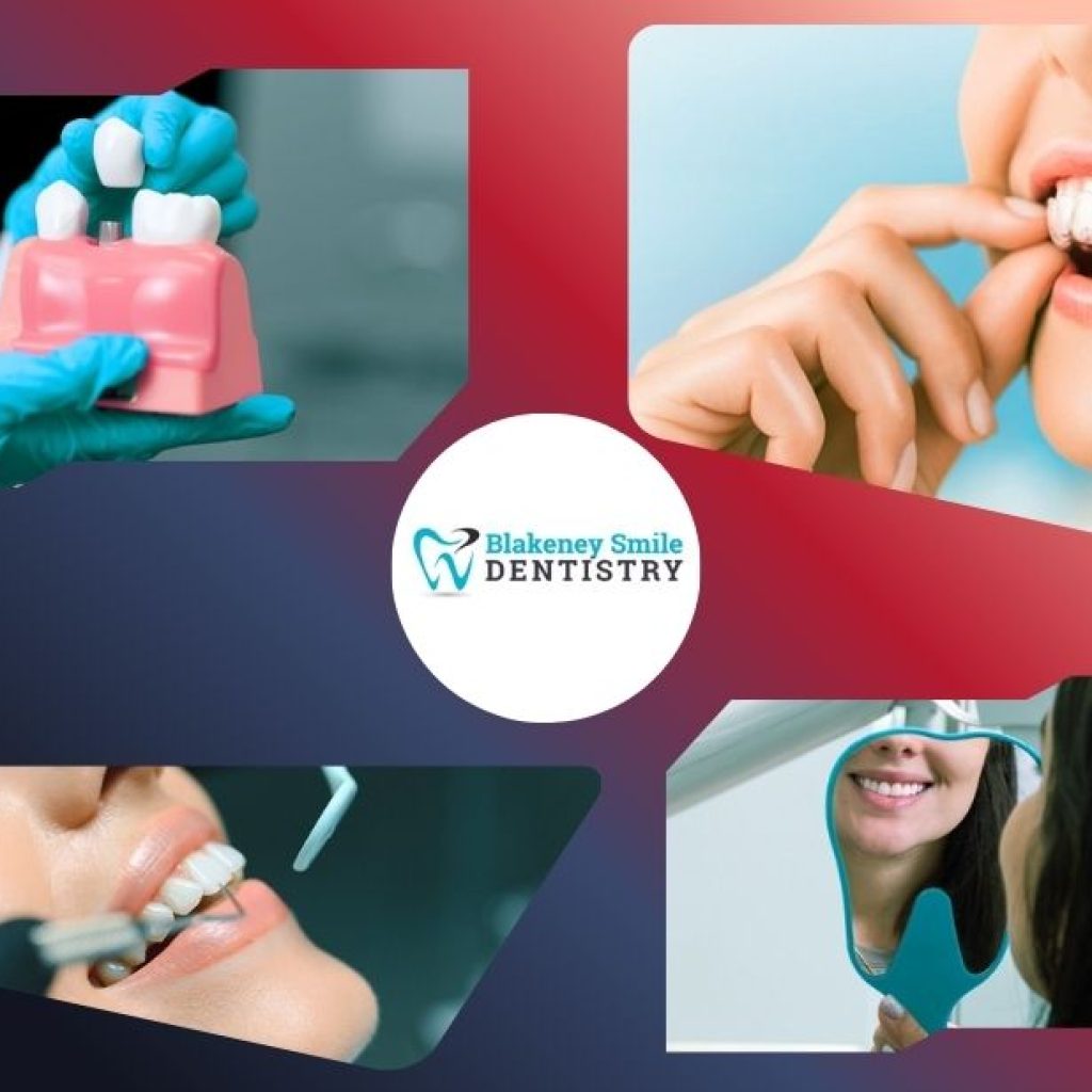 Transform Your Smile with Expert Cosmetic Dentistry in Ballantyne Area