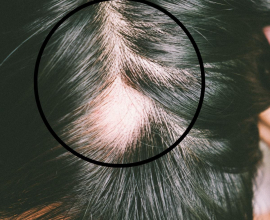 Wigs For Alopecia | Wigmedical.com